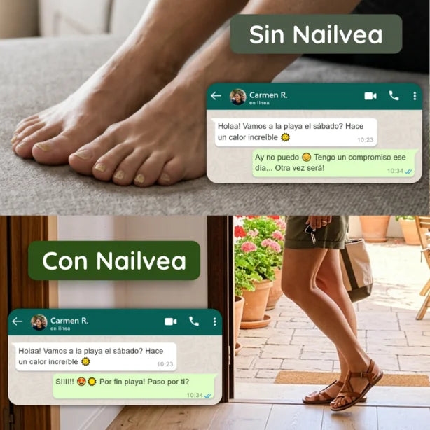 Aceite Antihongos Nailvea